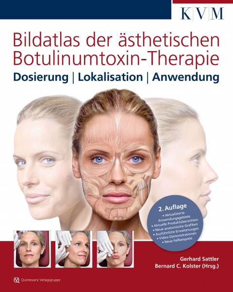 Bildatlas ästhetische Botulinumtoxin-Therapie, 2. Auflage, Dosierung-Lokalisation-Anwendung